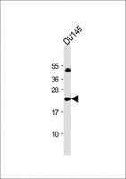 IL11 Antibody - Anti-IL11 Antibody (N-Term) at 1:2000 dilution + DU145 whole cell lysate Lysates/proteins at 20 µg per lane. Secondary Goat Anti-Rabbit IgG, (H+L), Peroxidase conjugated at 1/10000 dilution. Predicted band size: 21 kDa Blocking/Dilution buffer: 5% NFDM/TBST.