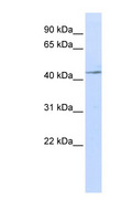 IL11RA Antibody - IL11RA antibody Western blot of Jurkat lysate. This image was taken for the unconjugated form of this product. Other forms have not been tested.