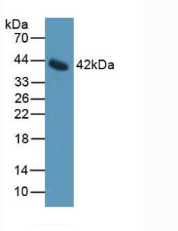 IL11RA Antibody - Western Blot; Sample: Mouse Serum.