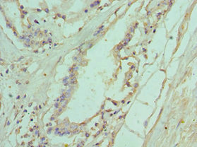IL11RA Antibody - Immunohistochemistry of paraffin-embedded human prostate tissue using IL11RA Antibody at dilution of 1:100
