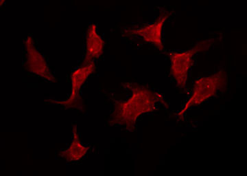 IL11RA Antibody - Staining HeLa cells by IF/ICC. The samples were fixed with PFA and permeabilized in 0.1% Triton X-100, then blocked in 10% serum for 45 min at 25°C. The primary antibody was diluted at 1:200 and incubated with the sample for 1 hour at 37°C. An Alexa Fluor 594 conjugated goat anti-rabbit IgG (H+L) Ab, diluted at 1/600, was used as the secondary antibody.