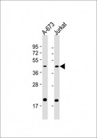 IL11RA Antibody - All lanes: Anti-IL11RA Antibody (C-Term) at 1:2000 dilution. Lane 1: A-673 whole cell lysate. Lane 2: Jurkat whole cell lysate Lysates/proteins at 20 ug per lane. Secondary Goat Anti-Rabbit IgG, (H+L), Peroxidase conjugated at 1:10000 dilution. Predicted band size: 45 kDa. Blocking/Dilution buffer: 5% NFDM/TBST.