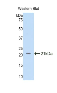 IL11RA Antibody - Western blot of recombinant IL11RA.  This image was taken for the unconjugated form of this product. Other forms have not been tested.