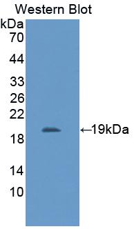 IL11RA Antibody - Western Blot; Sample: Recombinant protein.