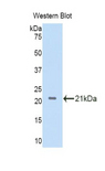 IL11RA Antibody - Western blot of recombinant IL11RA.  This image was taken for the unconjugated form of this product. Other forms have not been tested.