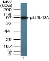 IL12A / p35 Antibody - Western blot of IL-12A in recombinant IL-35 using IL-12A antibody at 4 ug/ml.