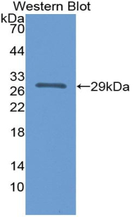 IL12A / p35 Antibody - Western blot of recombinant IL12A / p35.