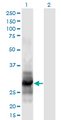 IL12A / p35 Antibody - Western Blot analysis of IL12A expression in transfected 293T cell line by IL12A monoclonal antibody (M02), clone 1A6.Lane 1: IL12A transfected lysate (Predicted MW: 28.3 KDa).Lane 2: Non-transfected lysate.