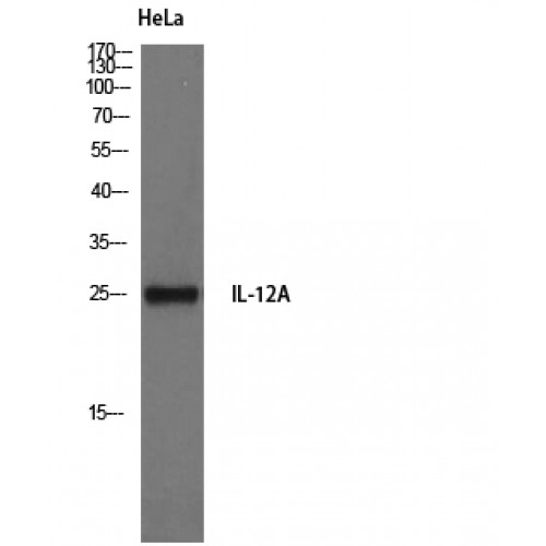 IL12A / p35 Antibody - Western blot of IL-12A antibody