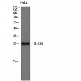 IL12A / p35 Antibody - Western blot of IL-12A antibody