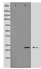 IL12A / p35 Antibody - Western blot of Interleukin?12A expression in HeLa cells
