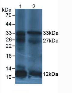 IL12A / p35 Antibody - Western Blot; Sample: Lane1: Human leukocyte Cells; Lane2: Human Lymphocytes Cells.