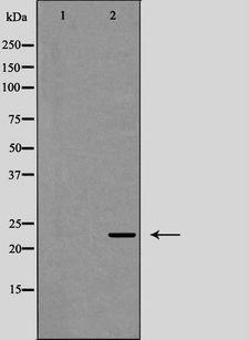 IL12A / p35 Antibody - Western blot analysis of Interleukin 12A expression in HeLa cells. The lane on the left is treated with the antigen-specific peptide.