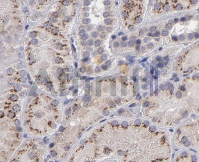 IL12A / p35 Antibody - 1/100 staining human kidney tissue by IHC-P. The sample was formaldehyde fixed and a heat mediated antigen retrieval step in citrate buffer was performed. The sample was then blocked and incubated with the antibody for 1.5 hours at 22°C. An HRP conjugated goat anti-rabbit antibody was used as the secondary antibody.