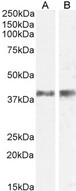 IL12B / IL12 p40 Antibody - Il12b / Il12p40 (mouse) Antibody (0.5µg/ml) staining of Mouse (A) and Rat (B) Skin lysate (35µg protein in RIPA buffer). Detected by chemiluminescencence.