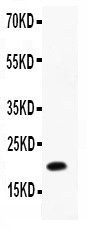 IL12B / IL12 p40 Antibody - IL12 p40 antibody Western blot. All lanes: Anti-IL12 P40 at 0.5 ug/ml. WB: Recombinant Rat IL12 P40 Protein 0.5ng. Predicted band size: 20 kD. Observed band size: 20 kD.