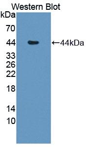 IL12B / IL12 p40 Antibody - Western blot of IL12B / IL12 p40 antibody.