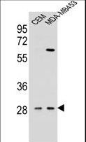 IL12B / IL12 p40 Antibody - IL12B Antibody western blot of CEM,MDA-MB453 cell line lysates (35 ug/lane). The IL12B antibody detected the IL12B protein (arrow).