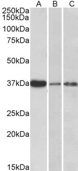 IL12B / IL12 p40 Antibody - IL12B / IL12 p40 antibody (0.3µg/ml) staining of Human Liver (A), Skin (B) and Tonsil (C) lysate (35µg protein in RIPA buffer). Primary incubation was 1 hour. Detected by chemiluminescence.