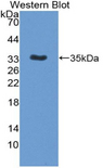 IL12B / IL12 p40 Antibody - Western blot of recombinant IL12B / IL12 p40.