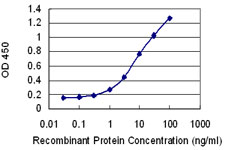 IL12B / IL12 p40 Antibody - Detection limit for recombinant GST tagged IL12B is 0.3 ng/ml as a capture antibody.