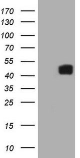 IL12B / IL12 p40 Antibody - HEK293T cells were transfected with the pCMV6-ENTRY control (Left lane) or pCMV6-ENTRY IL12B (Right lane) cDNA for 48 hrs and lysed. Equivalent amounts of cell lysates (5 ug per lane) were separated by SDS-PAGE and immunoblotted with anti-IL12B (1:2000).