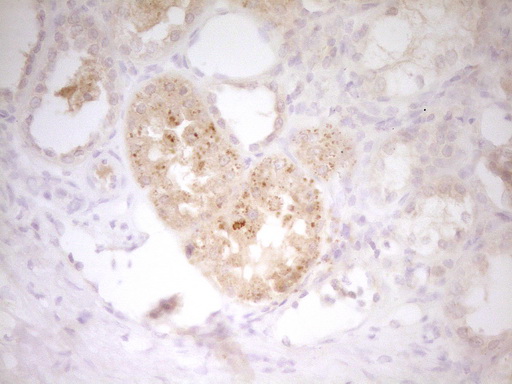 IL12B / IL12 p40 Antibody - IHC of paraffin-embedded Human Kidney tissue using anti-IL12B mouse monoclonal antibody. (Heat-induced epitope retrieval by 1 mM EDTA in 10mM Tris, pH8.5, 120°C for 3min).