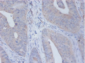 IL12B / IL12 p40 Antibody - Immunohistochemistry of paraffin-embedded human placenta tissue using IL12B Antibody at dilution of 1:100