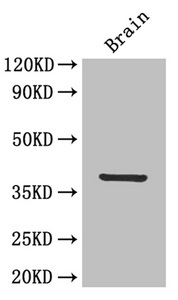 IL12B / IL12 p40 Antibody - Western Blot Positive WB detected in: Mouse brain All lanes: IL12 antibody at 4µg/ml Secondary Goat polyclonal to rabbit IgG at 1/50000 dilution Predicted band size: 37 kDa Observed band size: 37 kDa