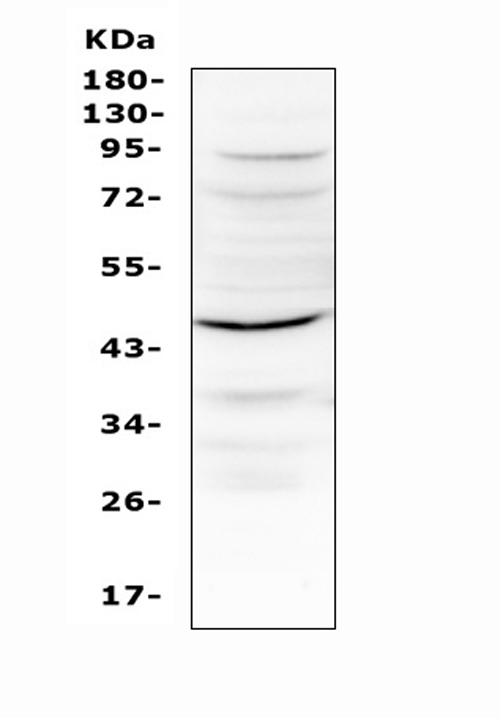 IL12B / IL12 p40 Antibody - Western blot analysis of IL12B using anti-IL12B antibody. Electrophoresis was performed on a 5-20% SDS-PAGE gel at 70V (Stacking gel) / 90V (Resolving gel) for 2-3 hours. The sample well of each lane was loaded with 50ug of sample under reducing conditions. Lane 1: mouse kidney tissue lysates. After Electrophoresis, proteins were transferred to a Nitrocellulose membrane at 150mA for 50-90 minutes. Blocked the membrane with 5% Non-fat Milk/ TBS for 1.5 hour at RT. The membrane was incubated with rabbit anti-IL12B antigen affinity purified polyclonal antibody at 0.5 ug/mL overnight at 4?, then washed with TBS-0.1% Tween 3 times with 5 minutes each and probed with a goat anti-rabbit IgG-HRP secondary antibody at a dilution of 1:10000 for 1.5 hour at RT. The signal is developed using an Enhanced Chemiluminescent detection (ECL) kit with Tanon 5200 system. A specific band was detected for IL12B at approximately 37-45KD. The expected band size for IL12B is at 37KD.