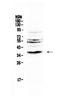 IL12B / IL12 p40 Antibody - Western blot - Anti-IL12B/Il 12 Picoband Antibody