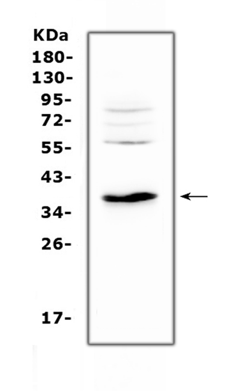 IL12B / IL12 p40 Antibody - Western blot analysis of IL12B using anti-IL12B antibody. Electrophoresis was performed on a 5-20% SDS-PAGE gel at 70V (Stacking gel) / 90V (Resolving gel) for 2-3 hours. The sample well of each lane was loaded with 50ug of sample under reducing conditions. Lane 1: rat kidney tissue lysates. After Electrophoresis, proteins were transferred to a Nitrocellulose membrane at 150mA for 50-90 minutes. Blocked the membrane with 5% Non-fat Milk/ TBS for 1.5 hour at RT. The membrane was incubated with rabbit anti-IL12B antigen affinity purified polyclonal antibody at 0.5 ug/mL overnight at 4?, then washed with TBS-0.1% Tween 3 times with 5 minutes each and probed with a goat anti-rabbit IgG-HRP secondary antibody at a dilution of 1:10000 for 1.5 hour at RT. The signal is developed using an Enhanced Chemiluminescent detection (ECL) kit with Tanon 5200 system. A specific band was detected for IL12B at approximately 37-45KD. The expected band size for IL12B is at 37KD.