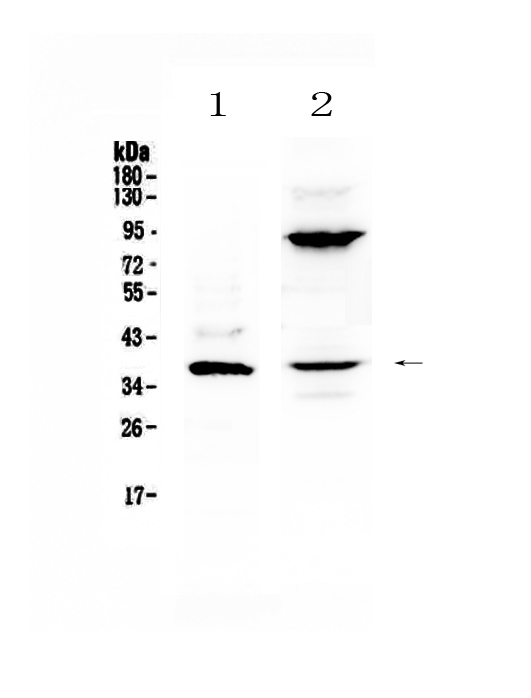 IL12B / IL12 p40 Antibody - Western blot - Anti-IL12B/Il 12 Picoband antibody