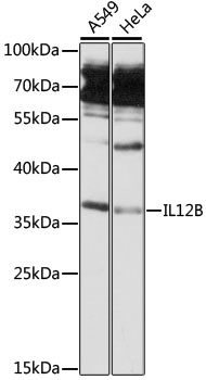 IL12B / IL12 p40 Antibody - Western blot analysis of extracts of various cell lines, using IL12B antibody at 1:3000 dilution. The secondary antibody used was an HRP Goat Anti-Rabbit IgG (H+L) at 1:10000 dilution. Lysates were loaded 25ug per lane and 3% nonfat dry milk in TBST was used for blocking. An ECL Kit was used for detection and the exposure time was 20s.