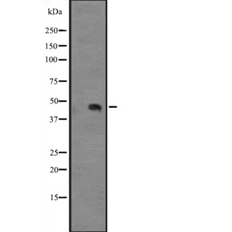 IL12B / IL12 p40 Antibody - Western blot analysis of IL12B expression in human fetal liver tissue lysate. The lane on the left is treated with the antigen-specific peptide.