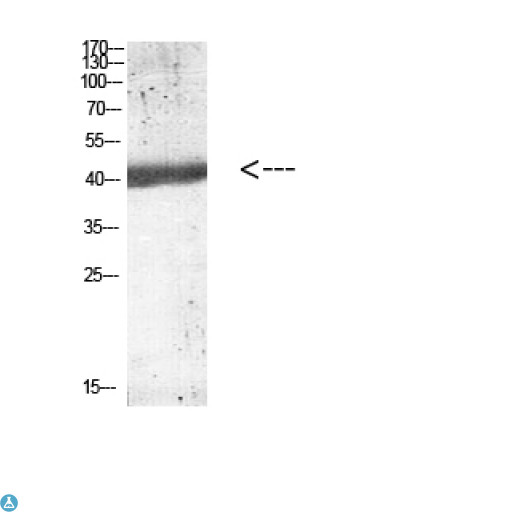 IL12B / IL12 p40 Antibody - Western blot analysis of mouse-kidney lysate, antibody was diluted at 1000. Secondary antibody was diluted at 1:20000.