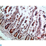 IL12B / IL12 p40 Antibody - Immunohistochemical analysis of paraffin-embedded human-colon, antibody was diluted at 1:200.