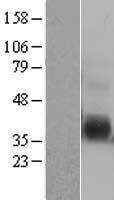 IL12B / IL12 p40 Protein - Western validation with an anti-DDK antibody * L: Control HEK293 lysate R: Over-expression lysate