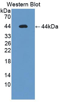 IL12RB1 / CD212 Antibody - Western blot of IL12RB1 / CD212 antibody.