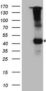 IL12RB1 / CD212 Antibody - HEK293T cells were transfected with the pCMV6-ENTRY control. (Left lane) or pCMV6-ENTRY IL12RB1. (Right lane) cDNA for 48 hrs and lysed. Equivalent amounts of cell lysates. (5 ug per lane) were separated by SDS-PAGE and immunoblotted with anti-IL12RB1. (1:500)