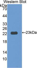 IL12RB1 / CD212 Antibody