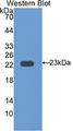 IL12RB1 / CD212 Antibody