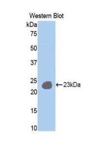 IL12RB1 / CD212 Antibody - Western blot of recombinant IL12RB1 / CD212.  This image was taken for the unconjugated form of this product. Other forms have not been tested.