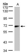 IL12RB1 / CD212 Antibody - Sample (30 ug whole cell lysate). A: A431. 7.5% SDS PAGE. IL12R / CD212 antibody diluted at 1:1000