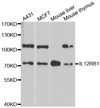 IL12RB1 / CD212 Antibody - Western blot analysis of extracts of various cell lines.