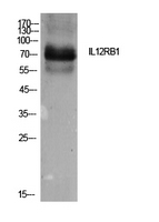 IL12RB1 / CD212 Antibody - Western Blot analysis of extracts from Hela cells using IL12RB1 Antibody.