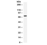 IL12RB1 / CD212 Antibody - Western blot testing of human HepG2 cell lysate with CD212 antibody at 0.5ug/ml. Predicted molecular weight: ~73/100 kDa (unmodified/glycosylated).