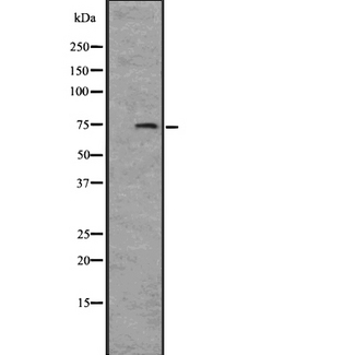 IL12RB1 / CD212 Antibody - Western blot analysis of IL12RB1 expression in A431 whole cells lysate. The lane on the left is treated with the antigen-specific peptide.