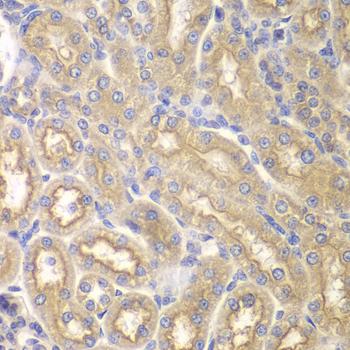 IL12RB1 / CD212 Antibody - Immunohistochemistry of paraffin-embedded Rat kidney using IL12RB1 Polyclonal Antibody at dilution of 1:200 (40x lens).