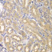 IL12RB1 / CD212 Antibody - Immunohistochemistry of paraffin-embedded Rat kidney using IL12RB1 Polyclonal Antibody at dilution of 1:200 (40x lens).